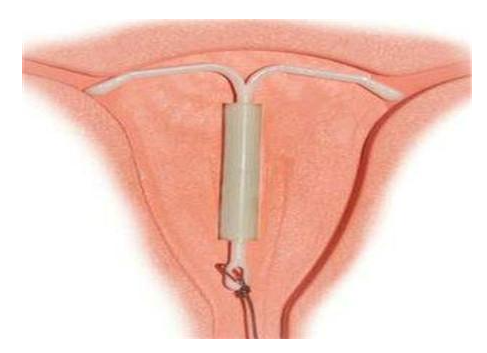 ��ԭ�ϭh(hu��n)ע�����(xi��ng),�ϭh(hu��n)�z��,�ϭh(hu��n)��